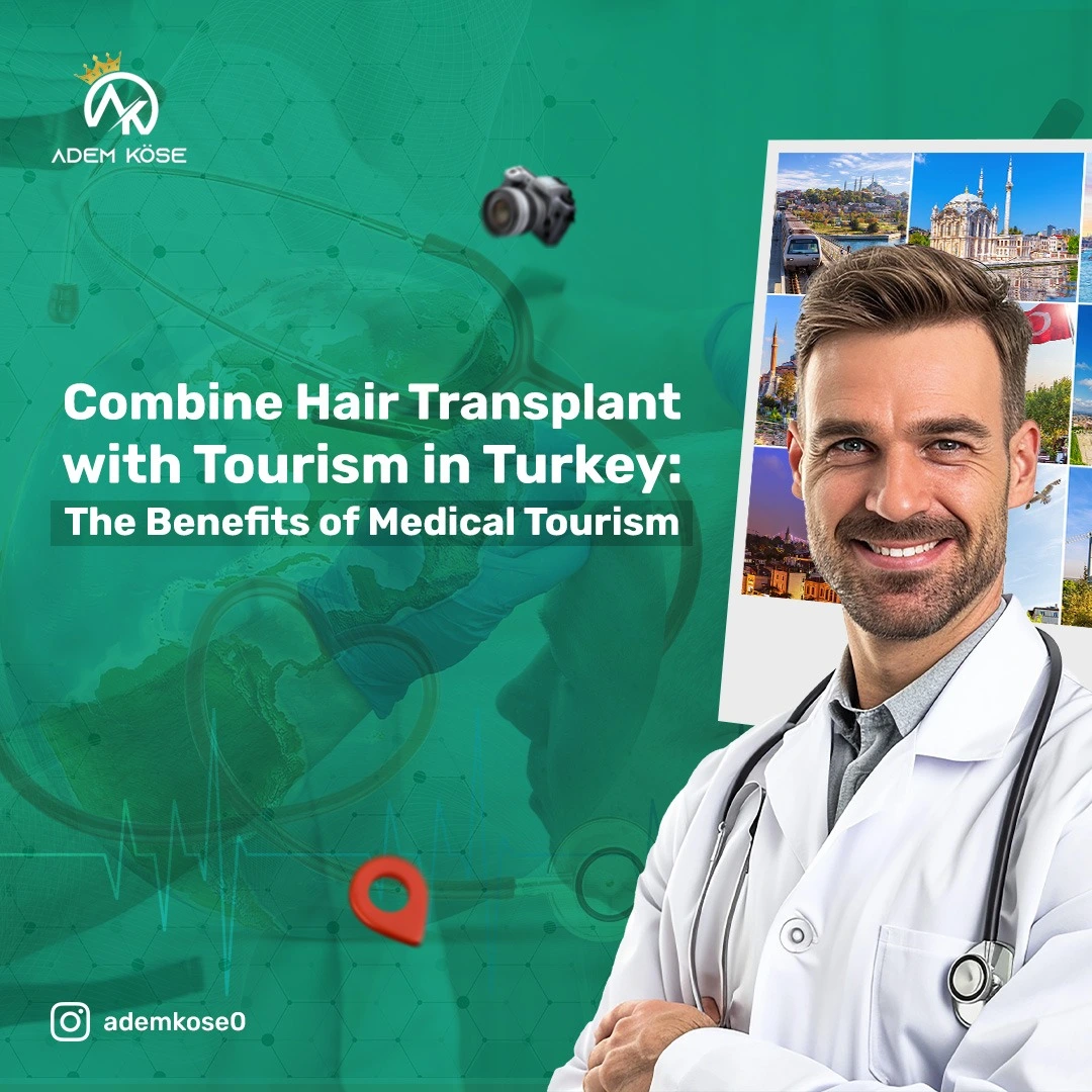 Hair Transplants and Tourism in Turkey The Perfect Vacation and Treatment Experience for Americans and Europeans