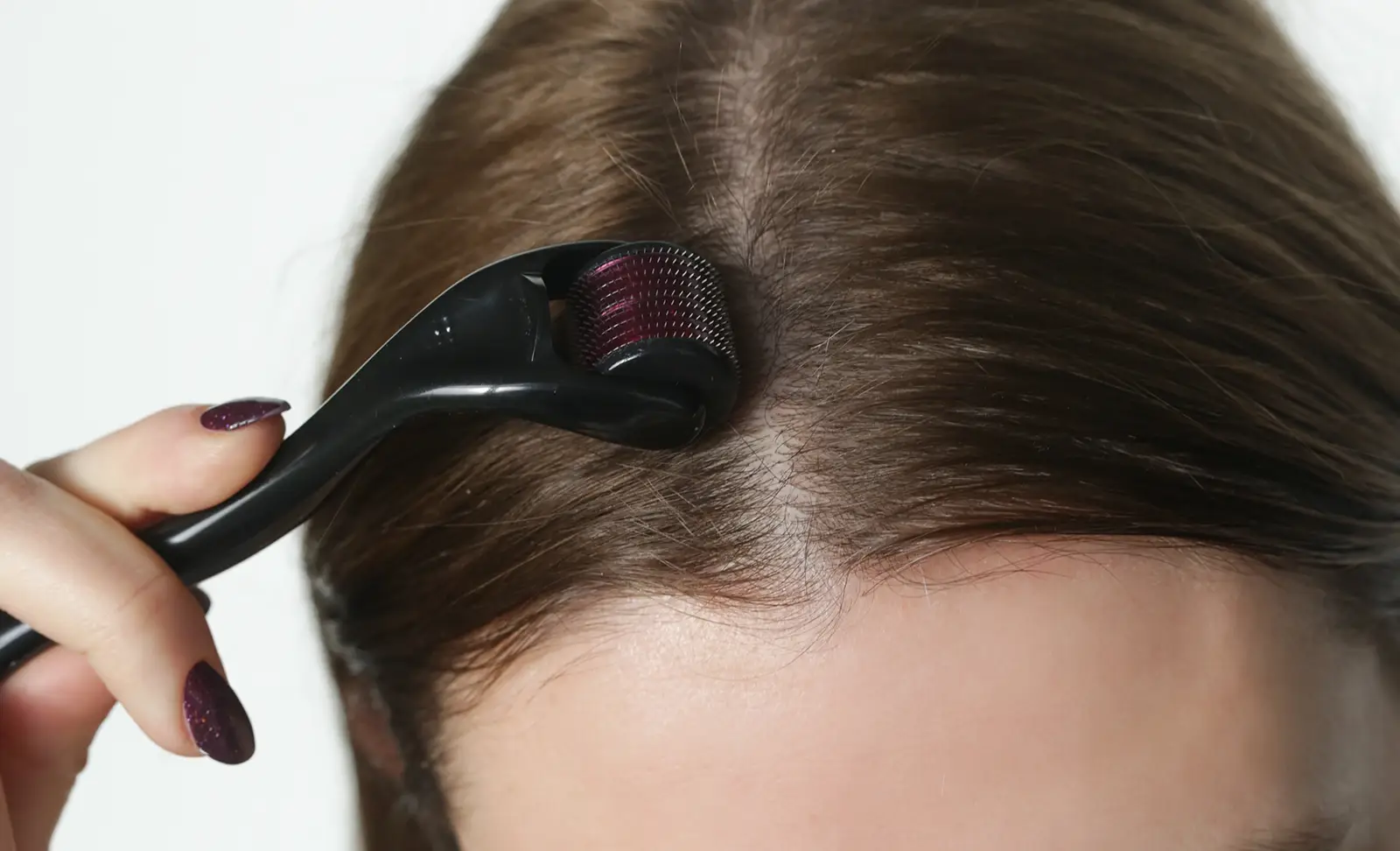 Dermaroller Saç Çıkarır Mı?