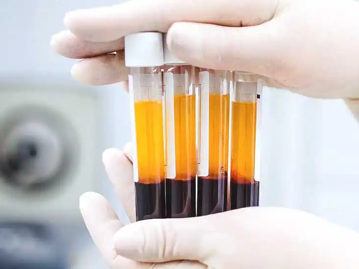 prp platelet rich plasma